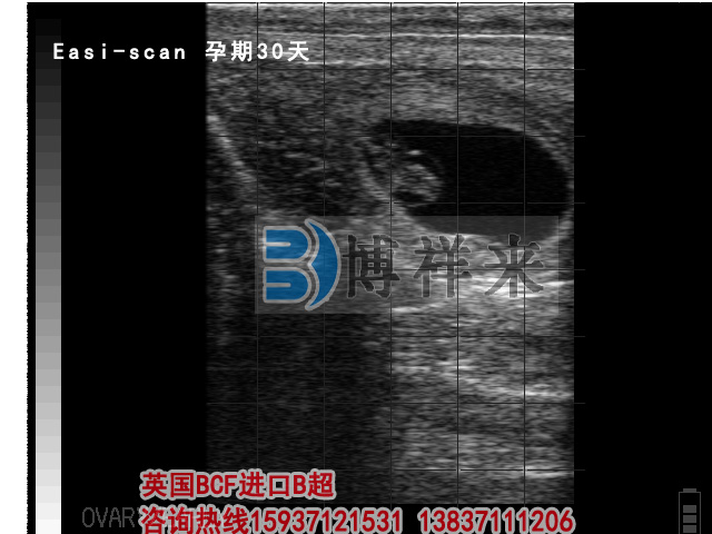 牛用B超檢測孕期30天影像圖