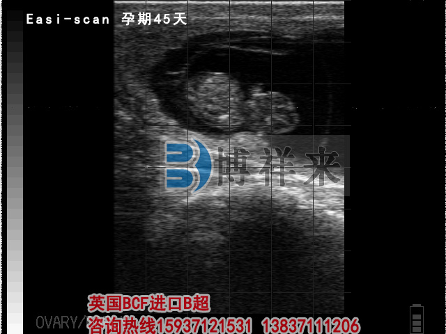 牛用B超檢測孕期45天影像圖